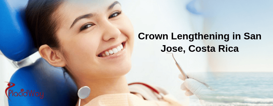 Crown Lengthening in San Jose, Costa Rica